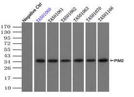 PIM2 Antibody in Immunoprecipitation (IP)