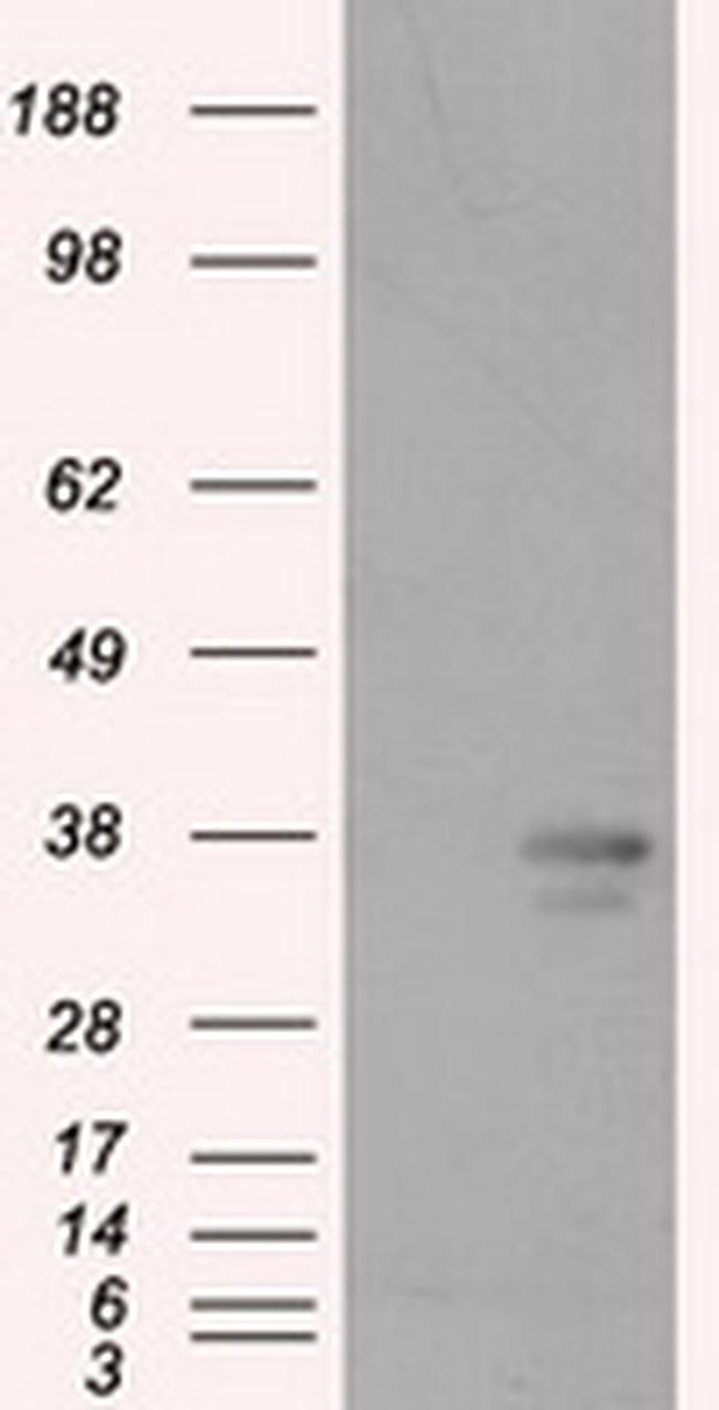 PIM2 Antibody in Western Blot (WB)