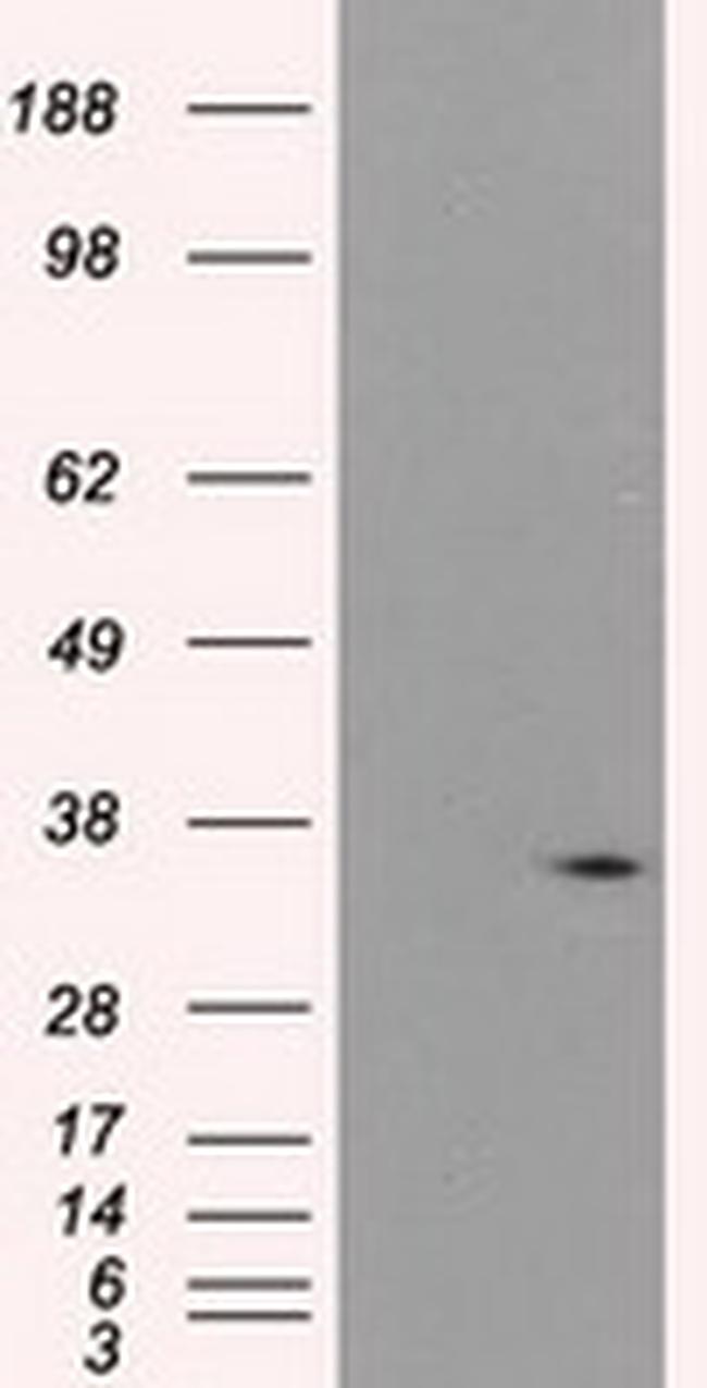 PIM2 Antibody in Western Blot (WB)