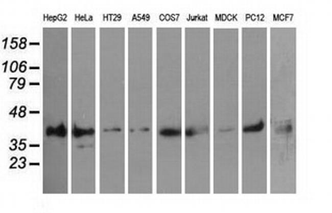 PIM2 Antibody in Western Blot (WB)