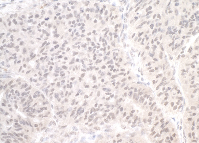 CDC20 Antibody in Immunohistochemistry (IHC)