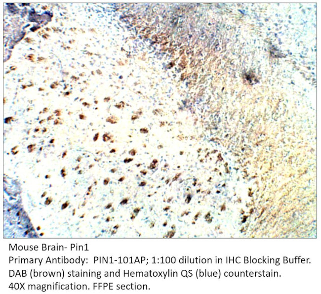 Pin1 Antibody in Immunohistochemistry (IHC)