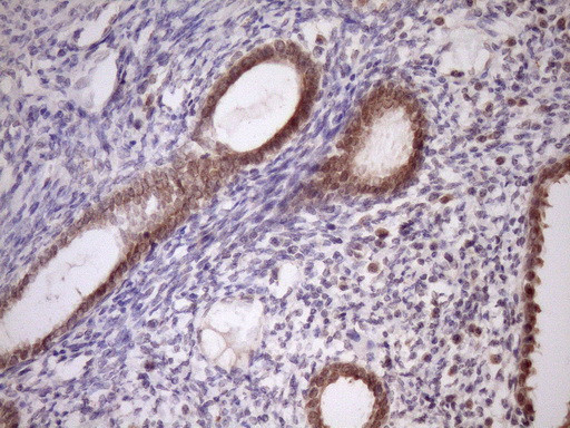 PIN4 Antibody in Immunohistochemistry (Paraffin) (IHC (P))