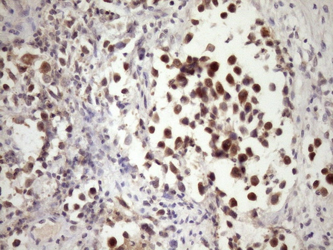 PIN4 Antibody in Immunohistochemistry (Paraffin) (IHC (P))