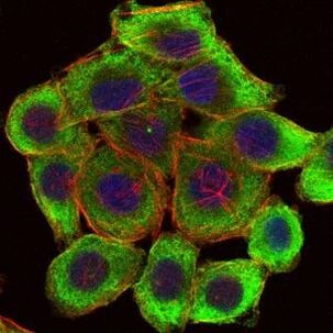 LIMS1 Antibody in Immunocytochemistry (ICC/IF)