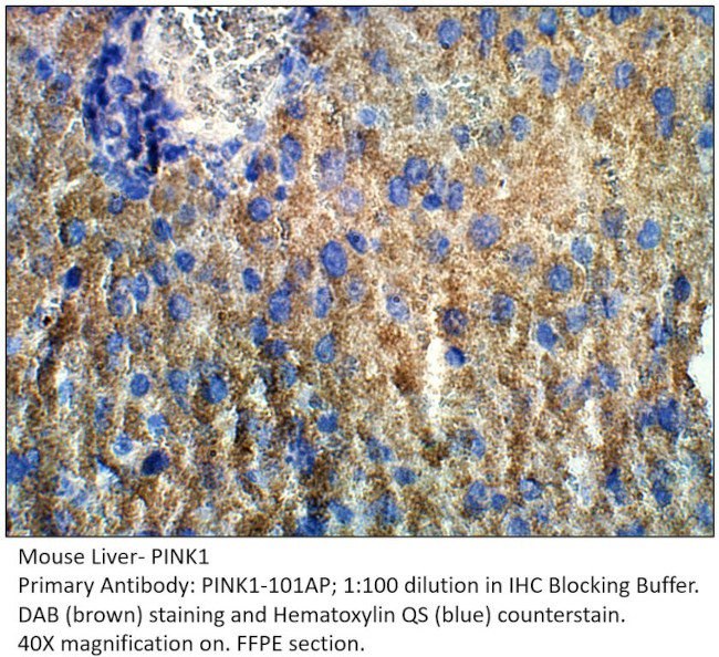 PINK1 Antibody in Immunohistochemistry (IHC)