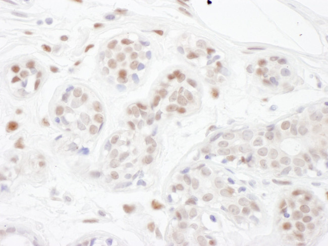 PINX1 Antibody in Immunohistochemistry (IHC)