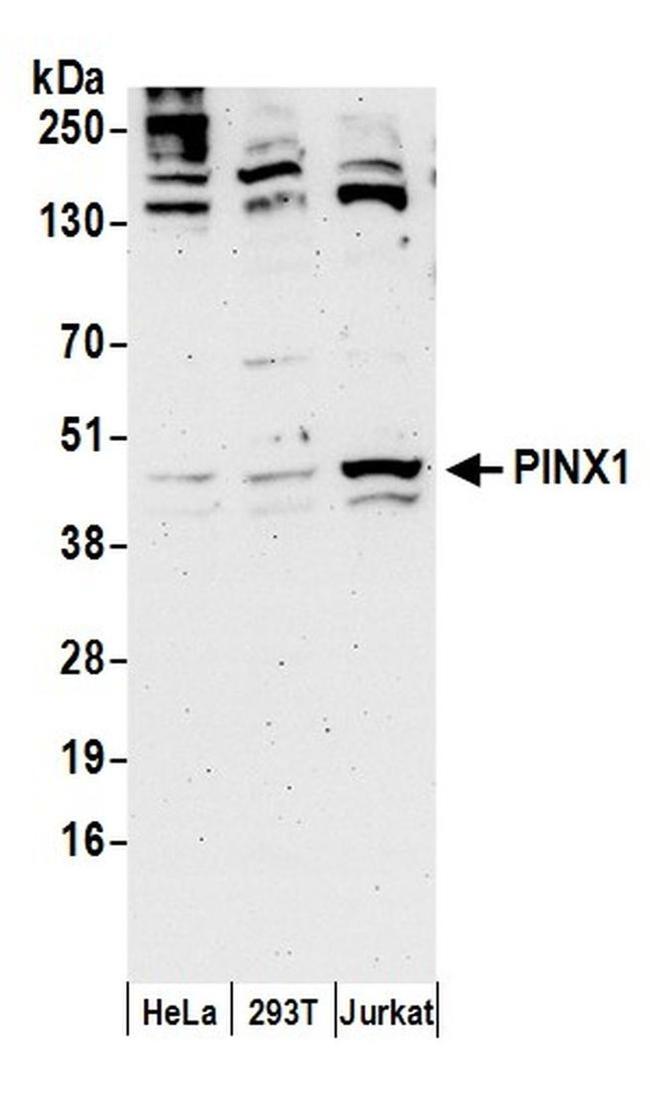 PINX1 Antibody in Western Blot (WB)