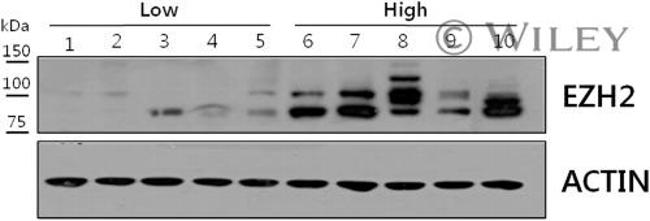 EZH2 Antibody in Western Blot (WB)