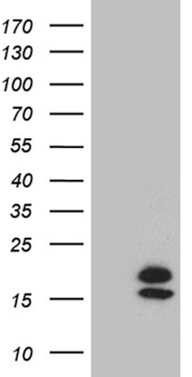 PIP Antibody in Western Blot (WB)