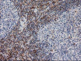 PIP4K2A Antibody in Immunohistochemistry (Paraffin) (IHC (P))