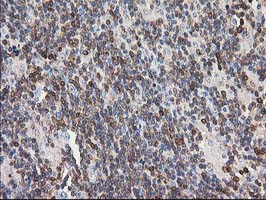 PIP4K2A Antibody in Immunohistochemistry (Paraffin) (IHC (P))