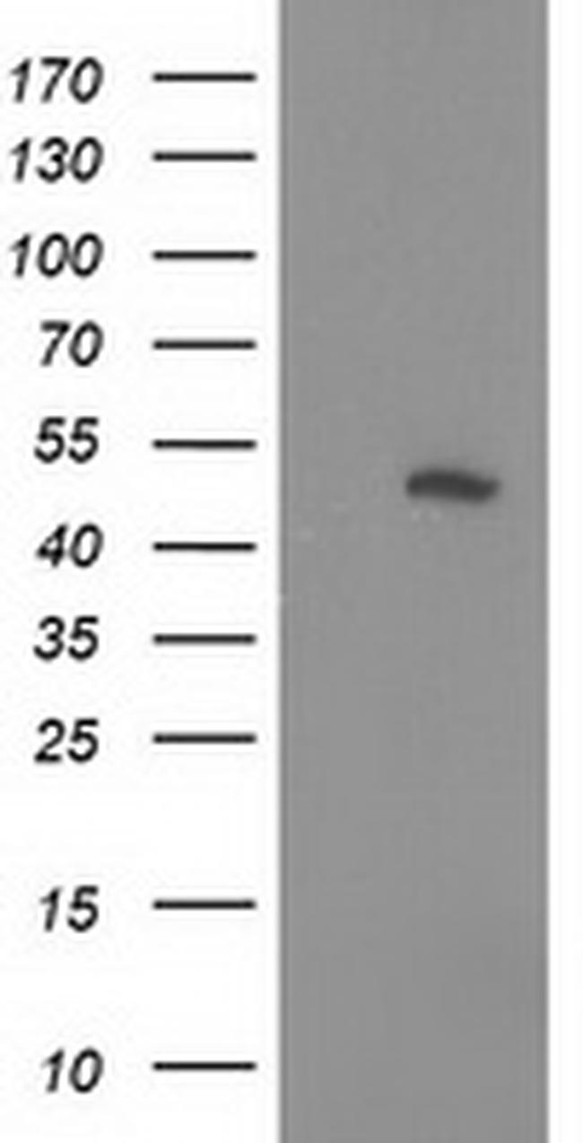 PIP4K2A Antibody in Western Blot (WB)