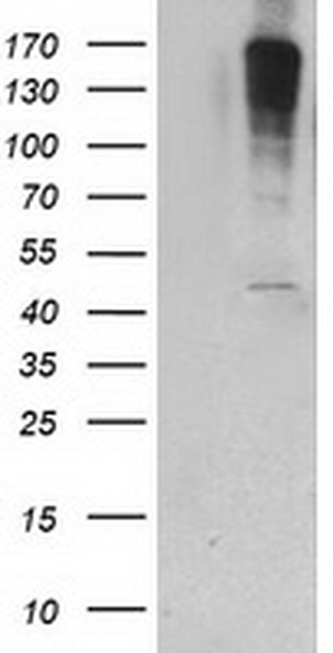 PIP4K2A Antibody in Western Blot (WB)