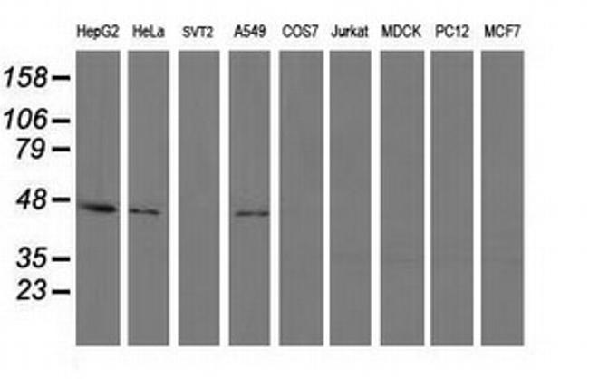 PIP4K2A Antibody in Western Blot (WB)