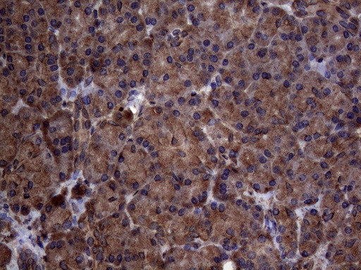 PISD Antibody in Immunohistochemistry (Paraffin) (IHC (P))