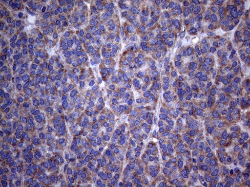 PISD Antibody in Immunohistochemistry (Paraffin) (IHC (P))