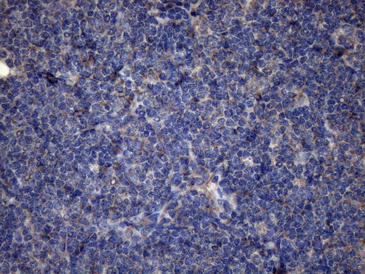 PISD Antibody in Immunohistochemistry (Paraffin) (IHC (P))