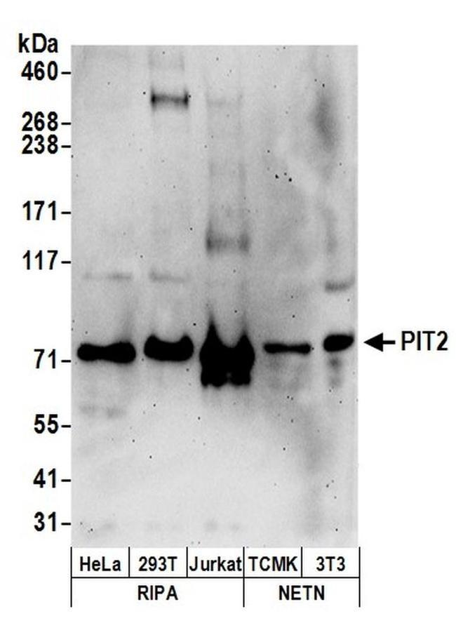 PIT2 Antibody in Western Blot (WB)