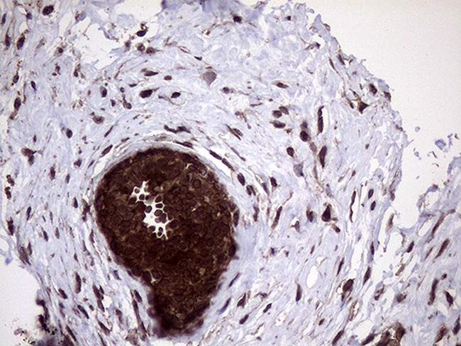 PITPNB Antibody in Immunohistochemistry (Paraffin) (IHC (P))