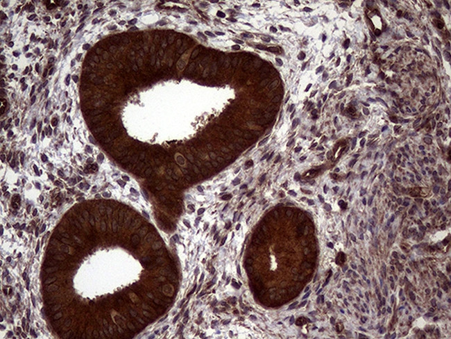 PITPNB Antibody in Immunohistochemistry (Paraffin) (IHC (P))