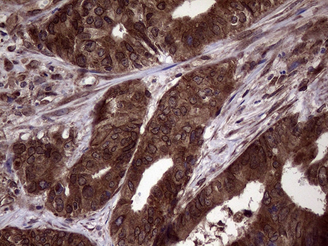 PITPNB Antibody in Immunohistochemistry (Paraffin) (IHC (P))