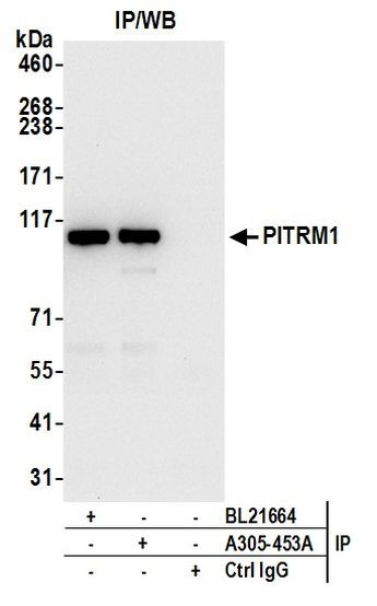 PITRM1 Antibody in Immunoprecipitation (IP)