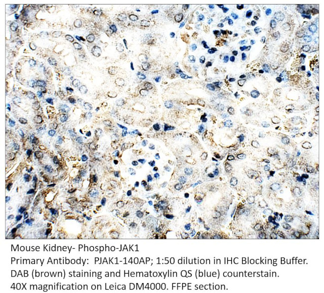 Phospho-JAK1 (Tyr1034, Tyr1035) Antibody in Immunohistochemistry (IHC)