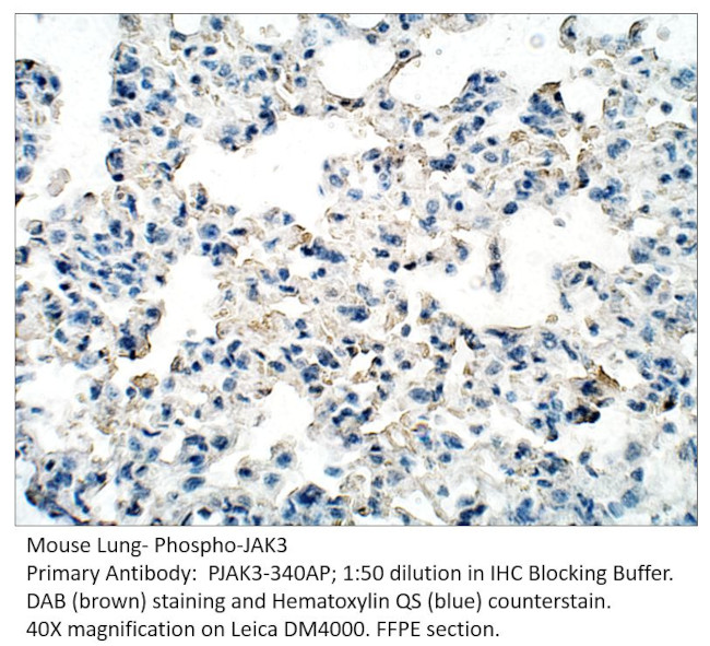 Phospho-JAK3 (Tyr785) Antibody in Immunohistochemistry (IHC)