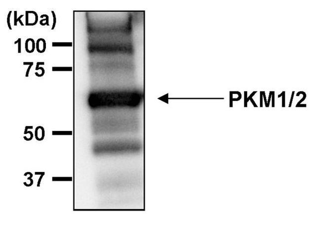 PKM1/PKM2 Antibody in Immunoprecipitation (IP)