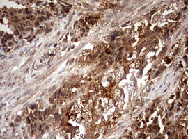 PKM1 Antibody in Immunohistochemistry (Paraffin) (IHC (P))