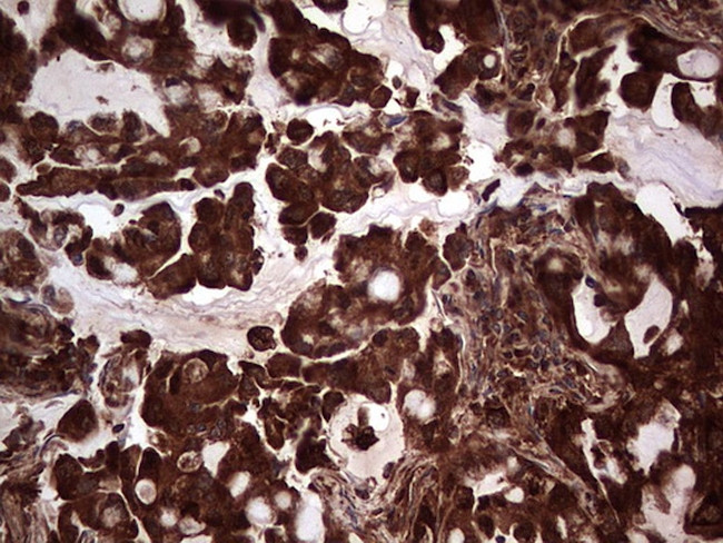 PKM2 Antibody in Immunohistochemistry (Paraffin) (IHC (P))