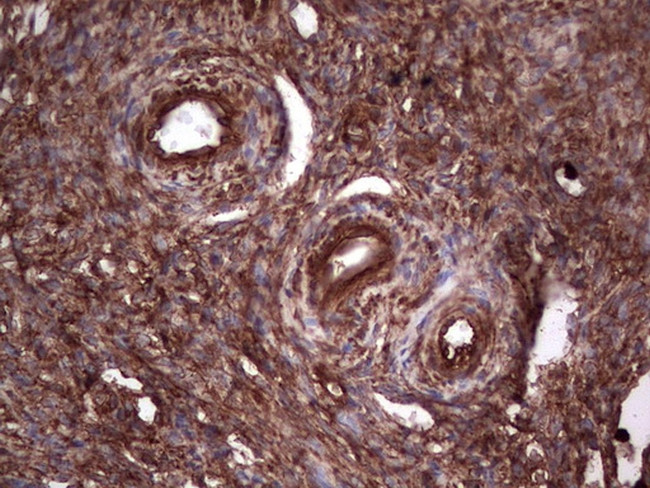 PKM2 Antibody in Immunohistochemistry (Paraffin) (IHC (P))