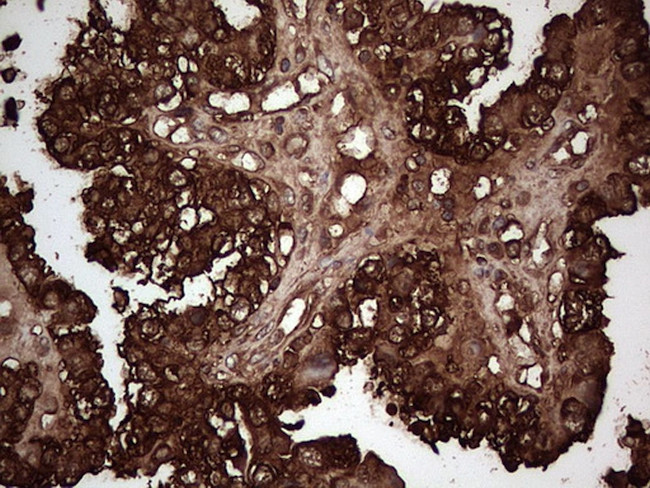 PKM2 Antibody in Immunohistochemistry (Paraffin) (IHC (P))