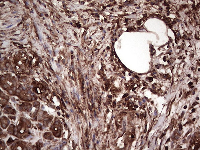 PKM2 Antibody in Immunohistochemistry (Paraffin) (IHC (P))