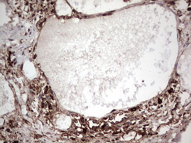 PKM2 Antibody in Immunohistochemistry (Paraffin) (IHC (P))