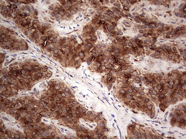 PKM2 Antibody in Immunohistochemistry (Paraffin) (IHC (P))