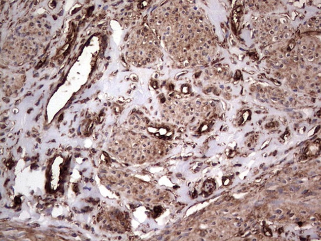 PKM2 Antibody in Immunohistochemistry (Paraffin) (IHC (P))