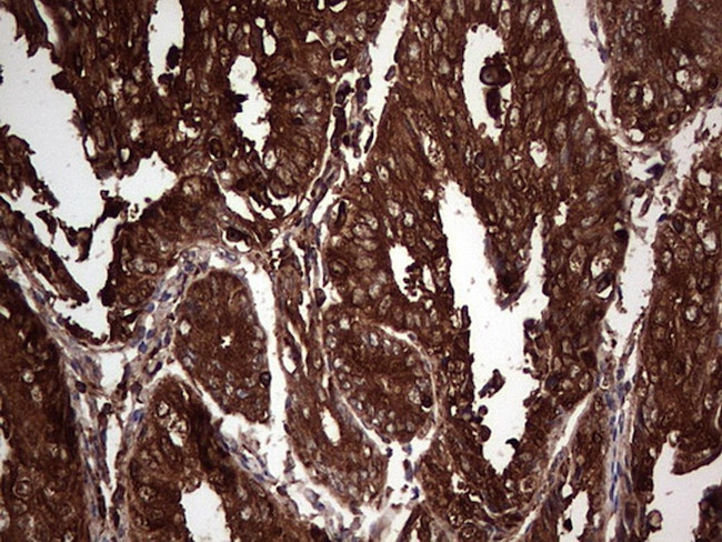 PKM2 Antibody in Immunohistochemistry (Paraffin) (IHC (P))