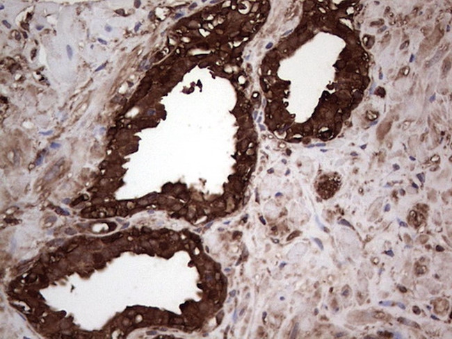 PKM2 Antibody in Immunohistochemistry (Paraffin) (IHC (P))