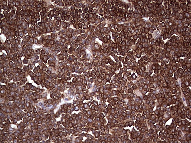 PKM2 Antibody in Immunohistochemistry (Paraffin) (IHC (P))