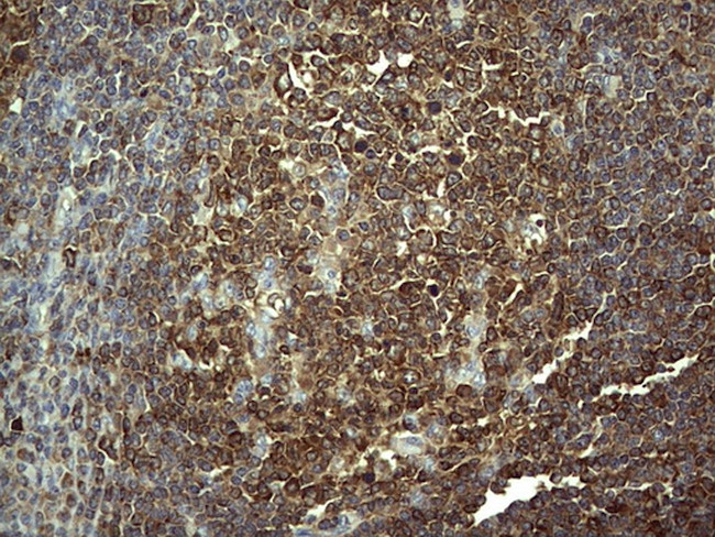 PKM2 Antibody in Immunohistochemistry (Paraffin) (IHC (P))