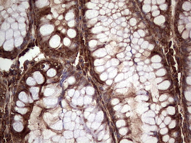 PKM2 Antibody in Immunohistochemistry (Paraffin) (IHC (P))