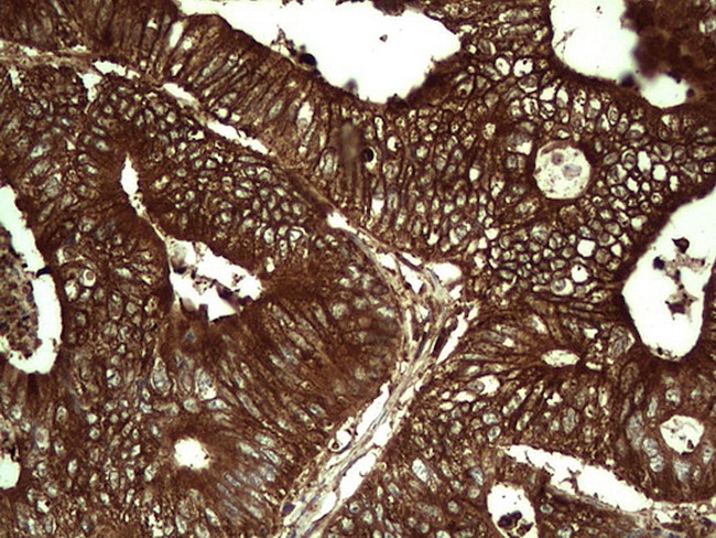 PKM2 Antibody in Immunohistochemistry (Paraffin) (IHC (P))