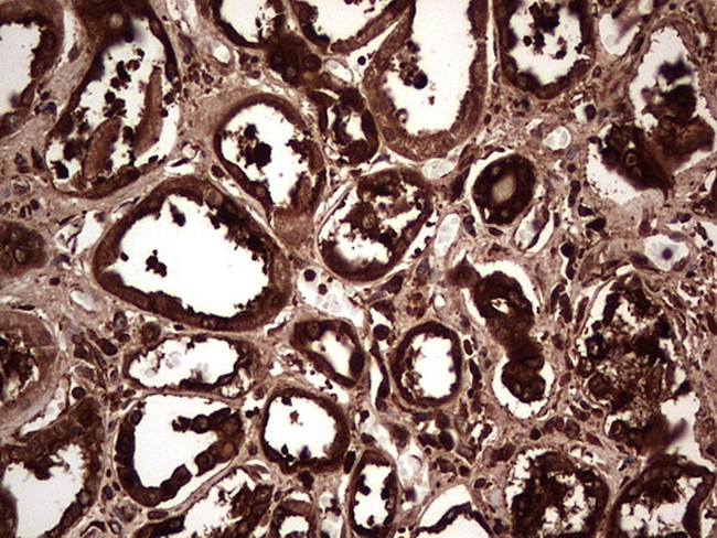 PKM2 Antibody in Immunohistochemistry (Paraffin) (IHC (P))