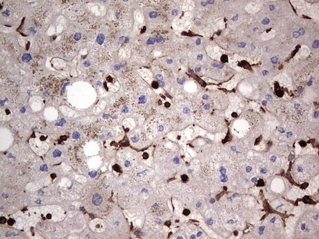 PKM2 Antibody in Immunohistochemistry (Paraffin) (IHC (P))