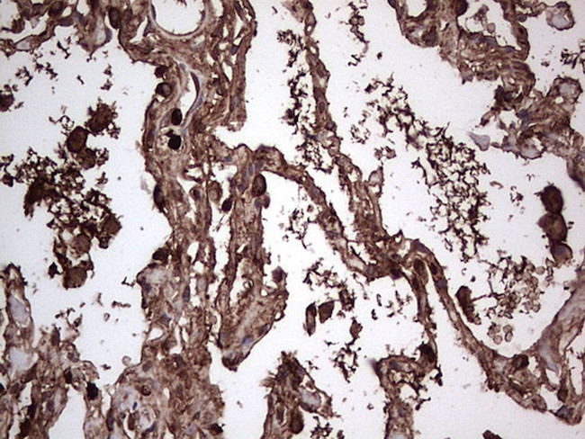 PKM2 Antibody in Immunohistochemistry (Paraffin) (IHC (P))