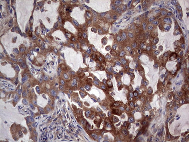 PKM2 Antibody in Immunohistochemistry (Paraffin) (IHC (P))