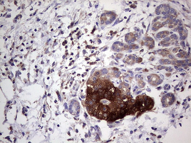 PKM2 Antibody in Immunohistochemistry (Paraffin) (IHC (P))