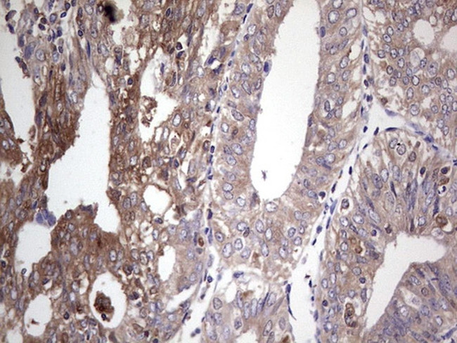 PKM2 Antibody in Immunohistochemistry (Paraffin) (IHC (P))